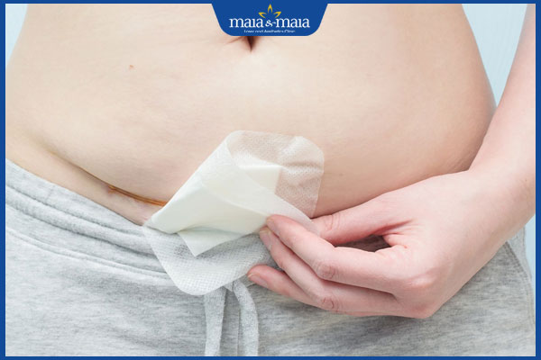 Cắt sẹo lồi giá bao nhiêu? Rủi ro khi phẫu thuật sẹo lồi giá rẻ 3 nhiễm trùng khi cắt bỏ sẹo