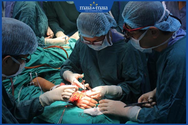 Ghép da trị sẹo lồi có tốt không? Quy trình và chi phí thực hiện 4 quy trình ghép da trị sẹo lồi