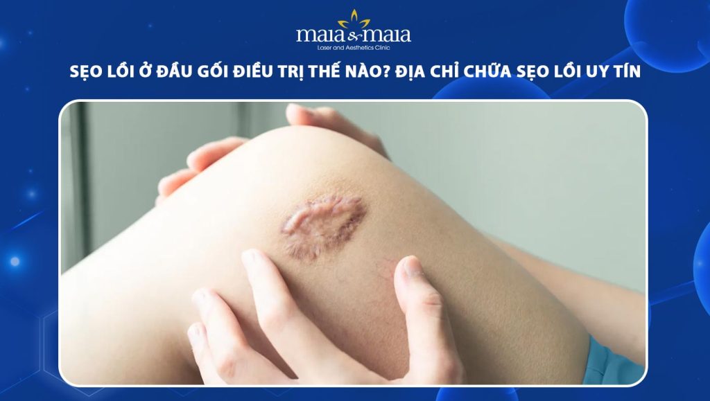 sẹo lồi ở đầu gối