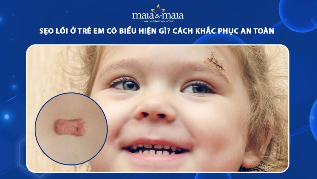 sẹo lồi ở trẻ em