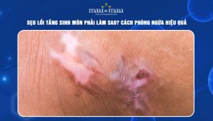 sẹo lồi tầng sinh môn