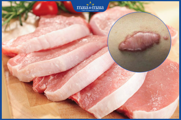 Ăn thịt heo có bị sẹo lồi không? Cách ăn an toàn 2 thịt heo