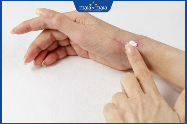 Ăn thịt ngan có bị sẹo lồi không? Gợi ý cách ăn không để lại sẹo 5 thoa gel giảm sẹo