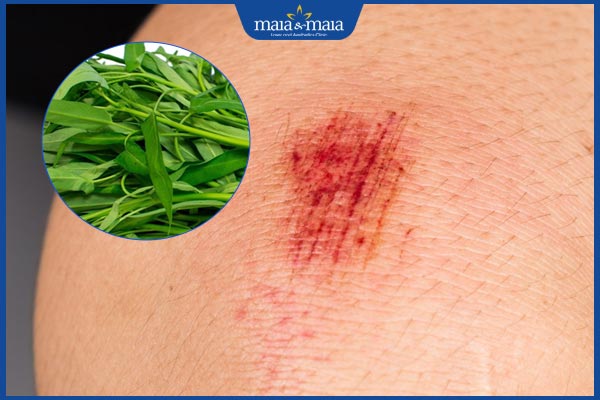 Ăn rau muống có bị sẹo lồi không? Chế độ ăn giúp da nhanh lành 3 thời gian kiêng rau muống