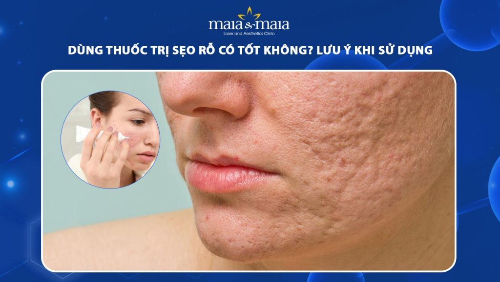 thuốc trị sẹo rỗ