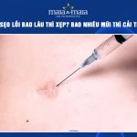 tiêm sẹo lồi bao lâu thì xẹp