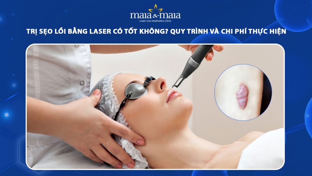 Trị sẹo lồi bằng laser có tốt không? Quy trình và chi phí thực hiện 1 trị sẹo lồi bằng laser