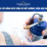 trị sẹo lồi bằng nitơ lỏng