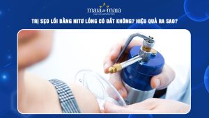 trị sẹo lồi bằng nitơ lỏng