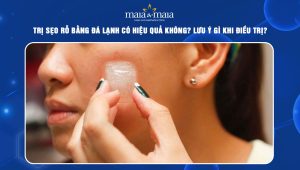 trị sẹo rỗ bằng đá lạnh