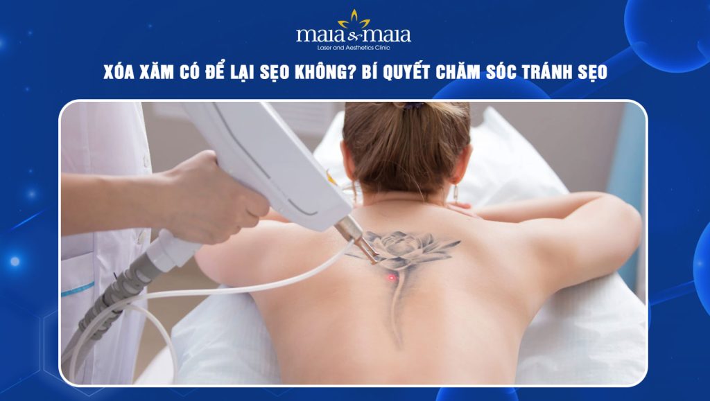 Xóa xăm có để lại sẹo không? Bí quyết chăm sóc tránh sẹo 1 xóa xăm có để lại sẹo