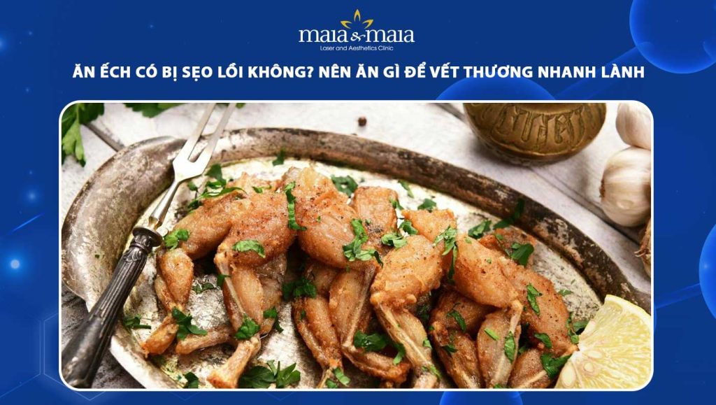 ăn ếch có bị sẹo lồi không