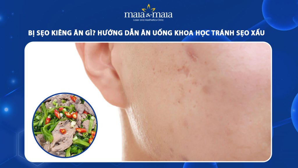 bị sẹo kiêng ăn gì