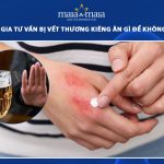 bị vết thương kiêng ăn gì để không bị sẹo