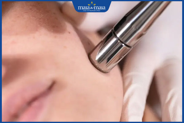 Cà da mặt trị sẹo lõm hiệu quả không? Quy trình và lưu ý thực hiện 2 cà da mặt