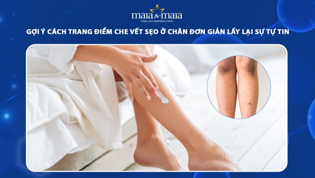 Cách trang điểm che vết sẹo ở chân đơn giản lấy lại tự tin 1 cách trang điểm che vết sẹo ở chân