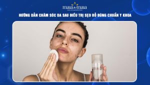 chăm sóc da sau điều trị sẹo rỗ
