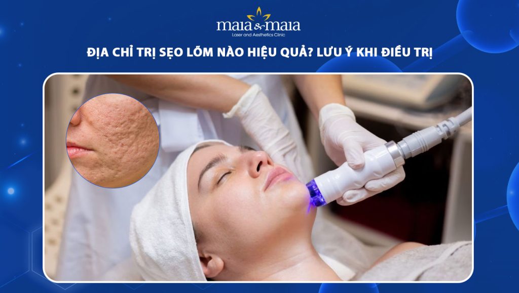 Địa chỉ trị sẹo lõm nào hiệu quả? Những lưu ý khi điều trị 1 địa chỉ trị sẹo lõm