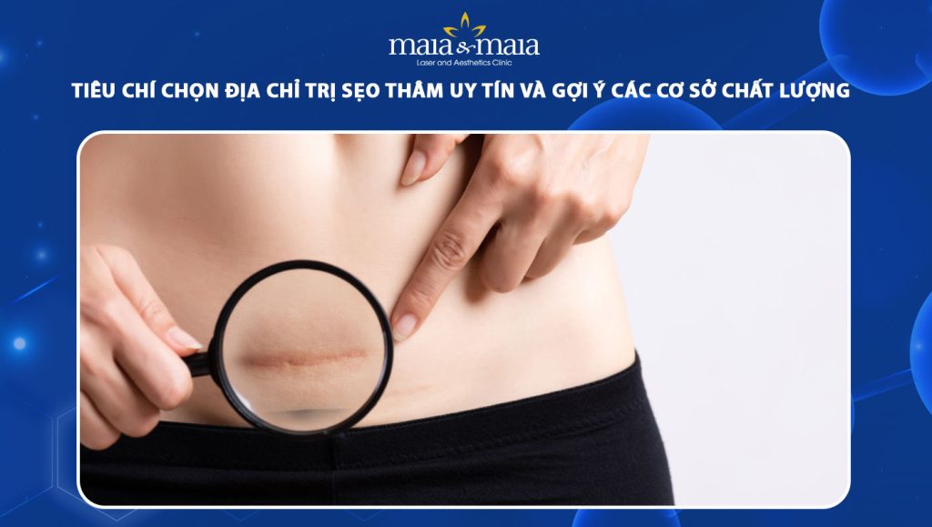 địa chỉ trị sẹo thâm