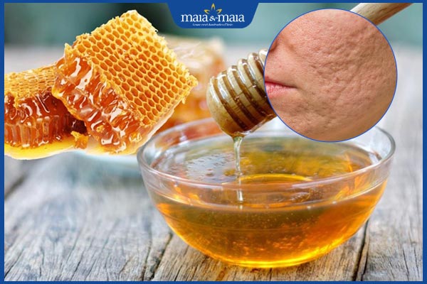 hiệu quả trị sẹo rỗ với mật ong