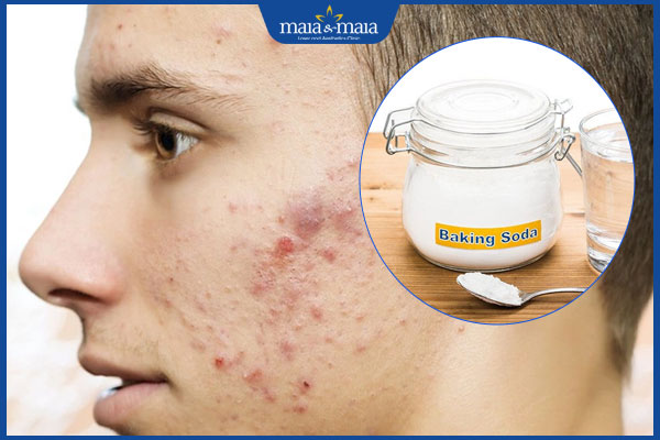 hiệu quả trị thâm bằng baking soda