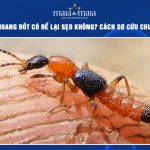 kiến ba khoang đốt có để lại sẹo không