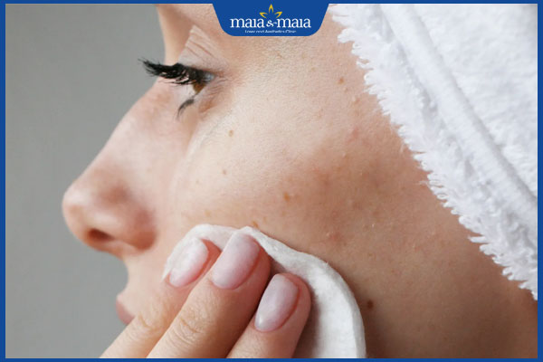 Peel da trị sẹo rỗ có tốt không? Quy trình và lưu ý khi thực hiện 6 làm sạch da sau peel