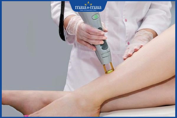 laser trị sẹo bỏng