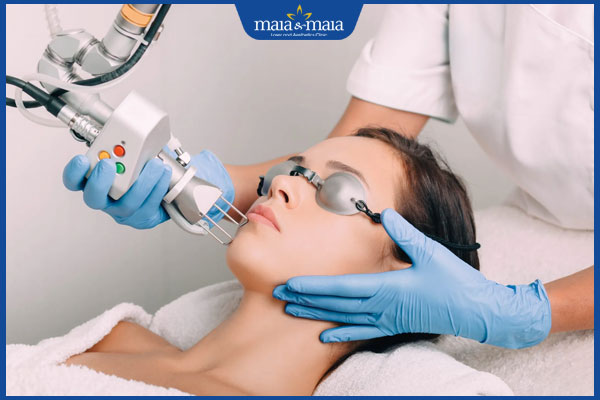 laser trị sẹo rỗ