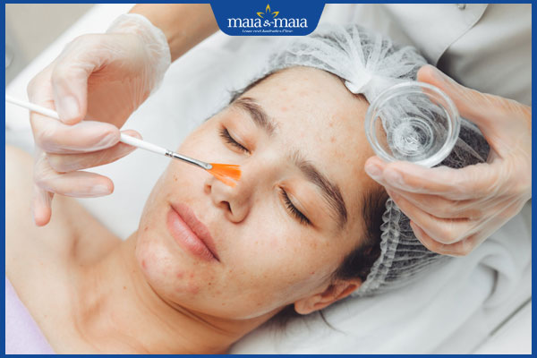 Điều trị sẹo lõm bằng lột da hóa chất có tốt không? 2 lột da hóa chất trị sẹo