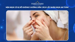 nặn mụn có bị rỗ không