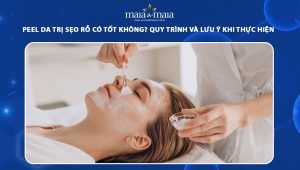 peel da trị sẹo rỗ