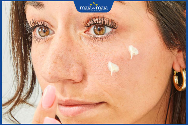 thoa kem trị mụn thâm