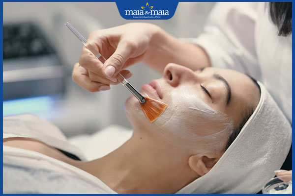 Cách nhận dạng sẹo rỗ đáy vuông và phác đồ điều trị dứt điểm 3 tiến hành peel da