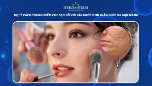 trang điểm che sẹo rỗ