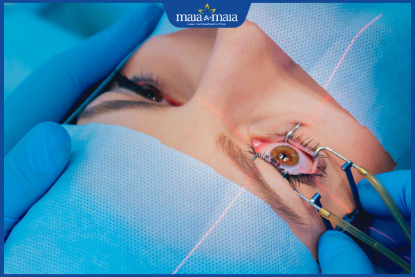 Trị sẹo giác mạc bằng laser: Giải pháp cải thiện thị thực an toàn 3 trị sẹo bằng laser PTK