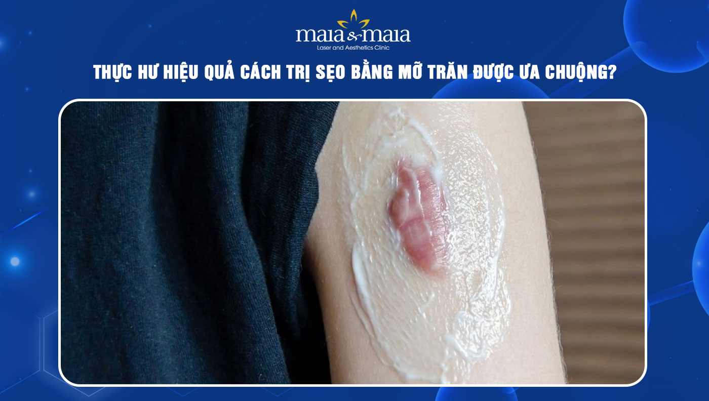 trị sẹo bằng mỡ trăn