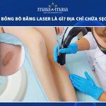 trị sẹo bỏng bô bằng laser
