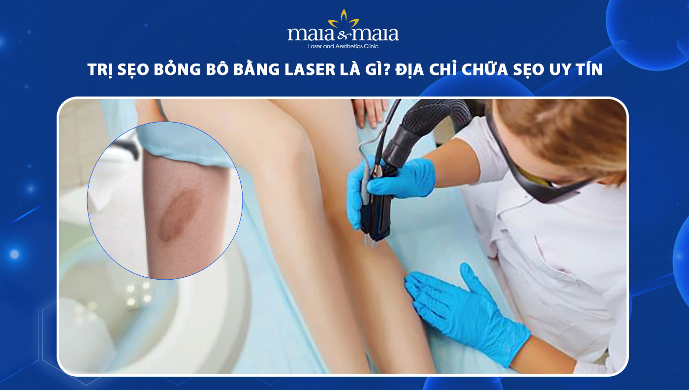 trị sẹo bỏng bô bằng laser