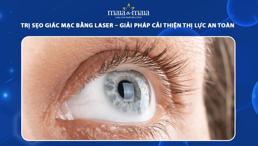 Trị sẹo giác mạc bằng laser: Giải pháp cải thiện thị thực an toàn 1 trị sẹo giác mạc bằng laser