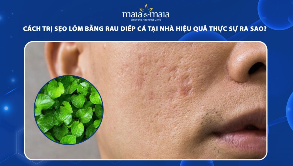 Cách trị sẹo lõm bằng rau diếp cá tại nhà hiệu quả ra sao? 1 trị sẹo lõm bằng rau diếp cá