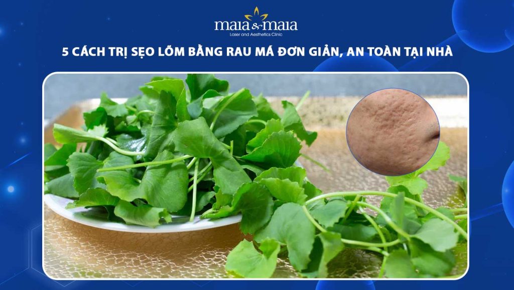 trị sẹo lõm bằng rau má