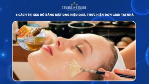 trị sẹo rỗ bằng mật ong