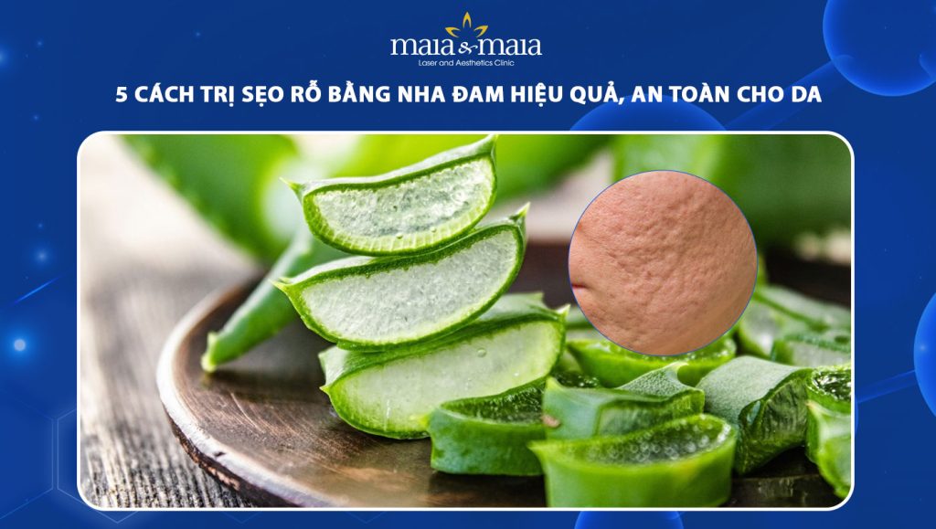 trị sẹo rỗ bằng nha đam
