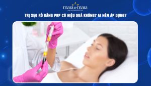 trị sẹo rỗ bằng prp