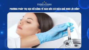 trị sẹo rỗ bằng tế bào gốc
