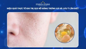 trị sẹo rỗ bằng trứng gà