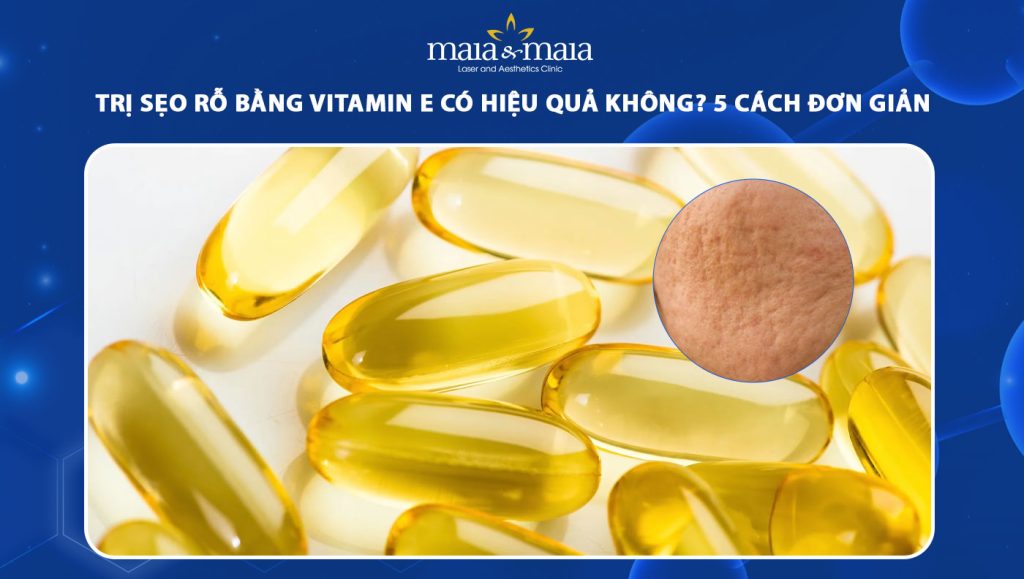 Trị sẹo rỗ bằng vitamin E có hiệu quả không? 5 cách đơn giản 1 trị sẹo rỗ bằng vitamin E