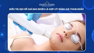 trị sẹo rỗ giá bao nhiêu