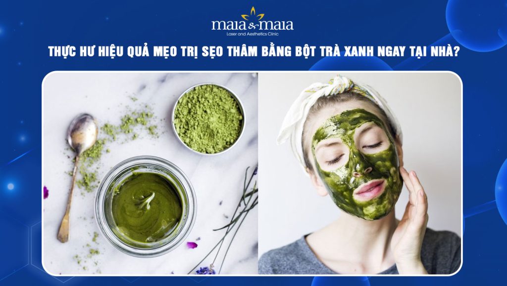 trị sẹo thâm bằng bột trà xanh